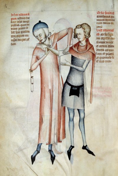 Kirurgi: lege undersøker pasientens ledd ved å strekke en arm (osteopat). Miniatyr i ""Liber notables Philippi den syvende kongen av frankerne, hentet fra bøkene til Galien"" skrevet av Gui (Guy) av Pavia av Guido da Vigevano da Pavia