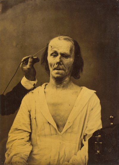 Et avslappet ansikt (til venstre); Dyp oppmerksomhet (til høyre) av Guillaume Benjamin Amant Duchenne