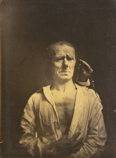 Spasmer av m. corrugator supercilii under veldig sterkt lys (til venstre); Et avslappet ansikt (fotografert i fullt solskinn) (til høyre) av Guillaume Benjamin Amant Duchenne