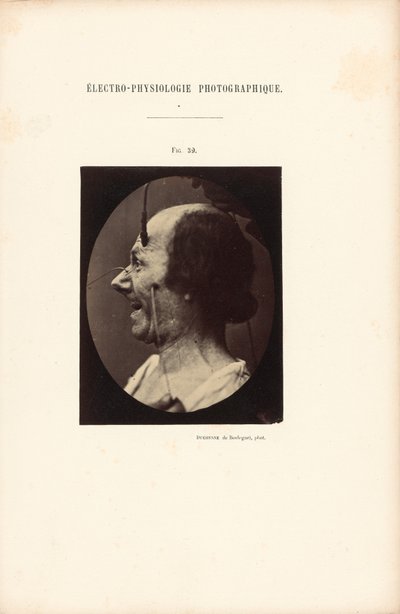  av Guillaume Benjamin Duchenne