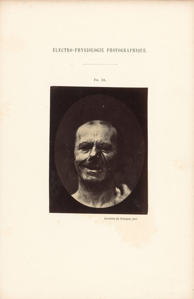  av Guillaume Benjamin Duchenne