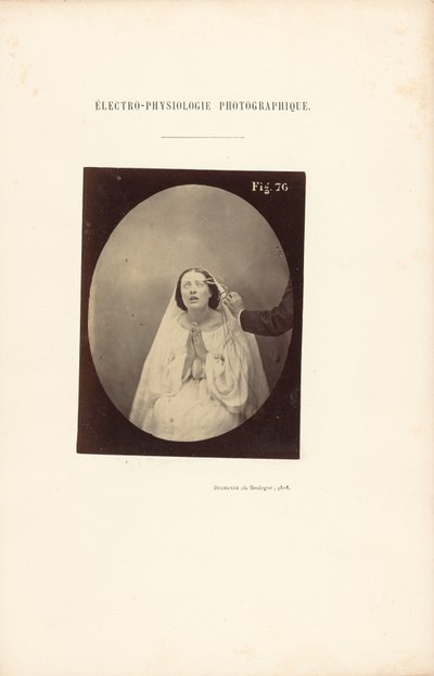  av Guillaume Benjamin Duchenne