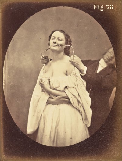  av Guillaume Benjamin Duchenne