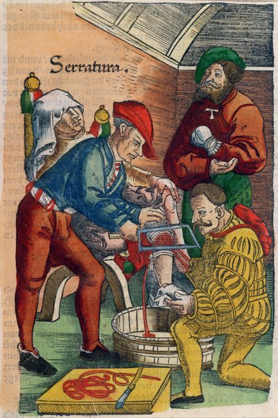 An Amputation, illustrasjon fra 