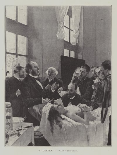 Avant lOperation (før operasjonen) av Henri Gervex