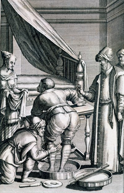 Blodsletting i bena, fra Medicina Aegyptiorum av Prospero Alpini, utgitt 1745 av Italian School