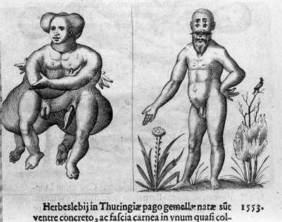 Ulike typer menneskelige monstre. Gravering fra "Monstrenes natur, årsaker og forskjeller" av Fortunio Liceti (1577-1656), italiensk vitenskapsmann. 1646 av Italian School