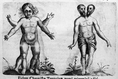 Ulike typer menneskelige monstre Gravering fra "Monstrenes natur, deres årsaker og forskjeller" av Fortunio Selvomi (1577-1656), italiensk vitenskapsmann. 1646 av Italian School