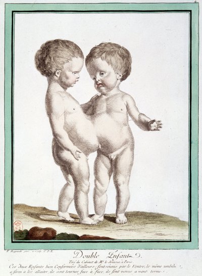 Siamesiske barn - i "" Naturens avvik"" av Régnault av Jean Baptiste Regnault