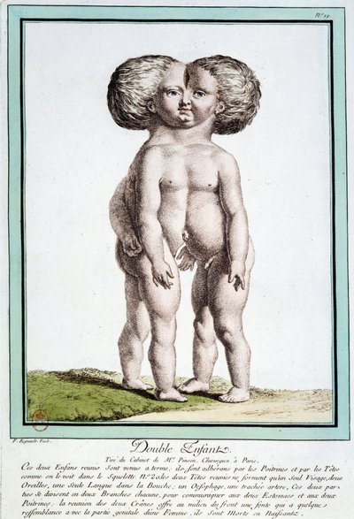 Siamesiske barn - i "" Naturens avvik"" av Régnault av Jean Baptiste Regnault