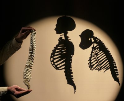 DOH, De første stegene, Ryggmargrekonstruksjon, Bruce Latimer, Cleveland Museum of Natura… av Kenneth Garrett