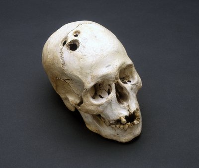 Trephination bronsealderhodeskalle, Jeriko, Palestina, 2200-2000 f.Kr. av Unbekannt Unbekannt