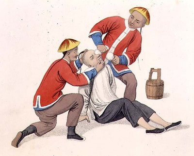 Das Verbrennen der Augen eines Mannes mit Kalk, Platte 11 aus 