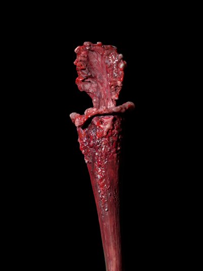  av Mat Collishaw