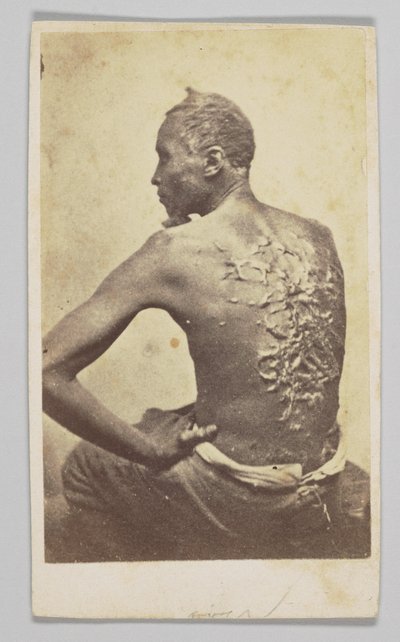 Gordon under medisinsk inspeksjon, 1863. av McPherson and Oliver