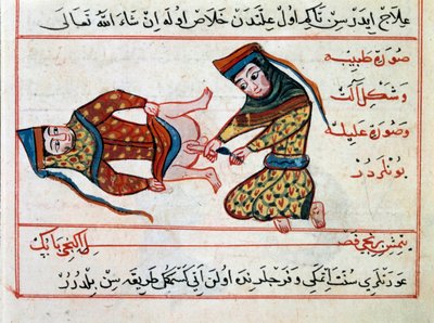 Medisin: operasjon av en hermafoditt. Miniatyr fra en godbit av tyrkisk medisin av Sharaf al-din av Ottoman School