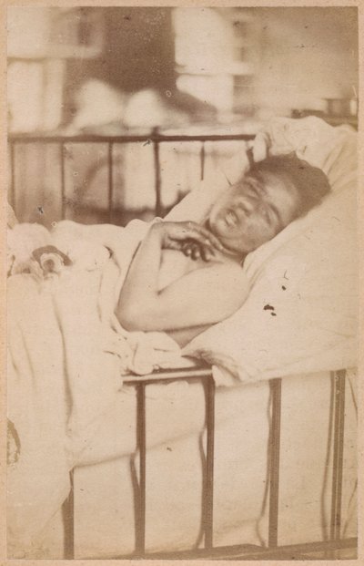 Hysterisk epilepsi, permanent sammentrekning, plate XXVIII fra 