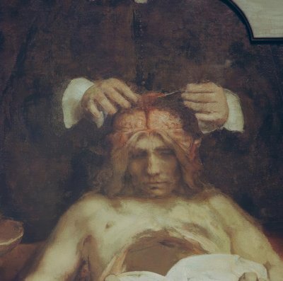 Anatomien til Dr. Johan Deijman av Rembrandt van Rijn