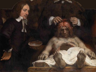 Dr. Jan Deijmans anatomi-leksjon, 1656 av Rembrandt van Rijn