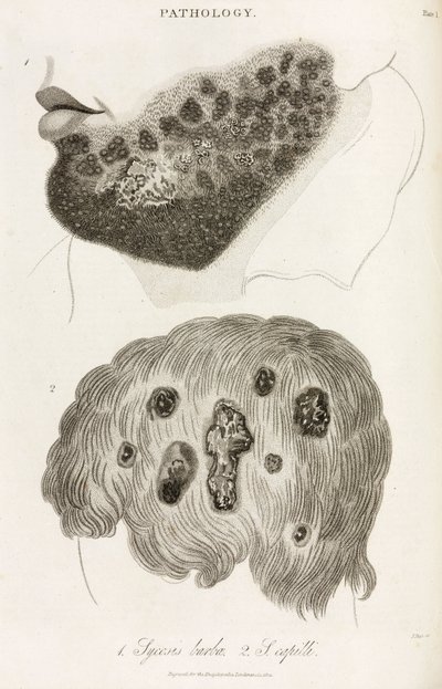 Dermatologi Hudsykdommer av John Pardon