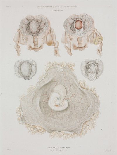 Gynekologi Menneskelig livmor med embryo, ca 1847-1859 av John Pardon