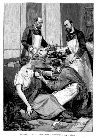 En tuberkulosepasient som ble gitt en transfusjon av geiteblod, 1891 av Unbekannt