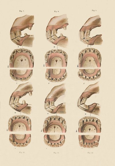 Beskrivelse av plate som viser alderen, som angitt av tennene, c1879. av Unbekannt