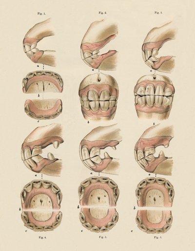 Beskrivelse av plate som viser alderen, som angitt av tennene, c1879. av Unbekannt