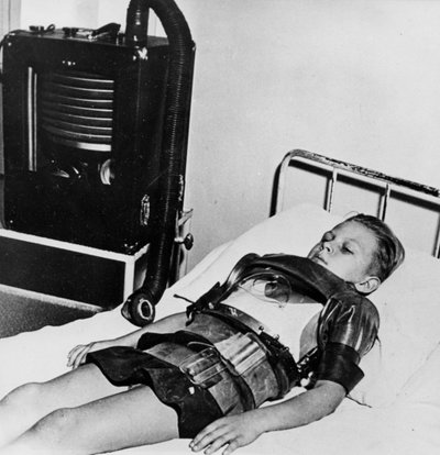 Elleve år gammel gutt i en jernlunge, Beaujon Hospital, Paris, c1947-1951 av Unbekannt