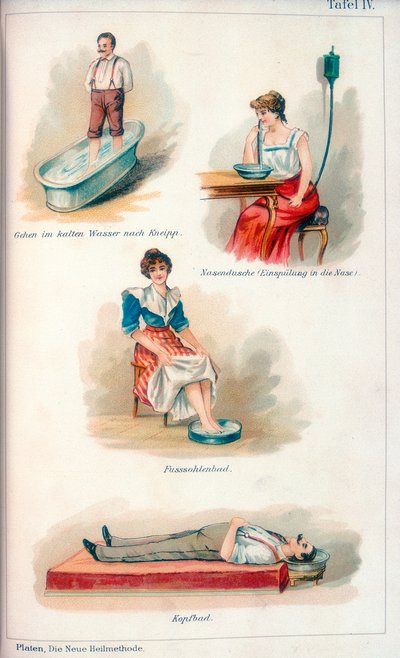 Hydroterapibehandlinger, c1902 av Unbekannt