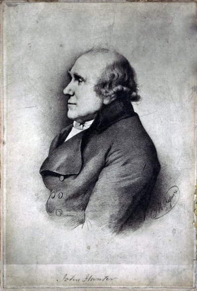 John Hunter , britisk kirurg og anatom, ca 1770-tallet av Unbekannt