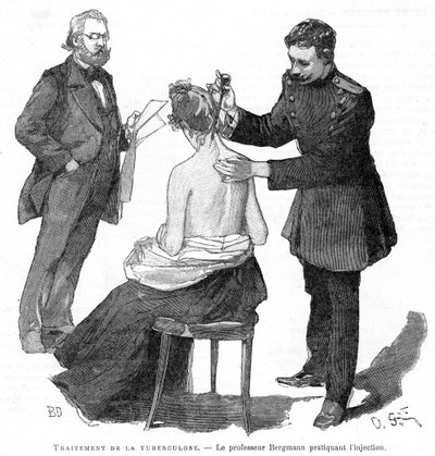 Professor Bergmann injiserer en tuberkulosepasient, 1891 av Unbekannt