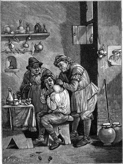 A charlatan surgeon in the 18th century examining a shoulder injury. (From an engraving of time). Engraving in “” La Nature: revue des sciences et de leurs applications aux arts et a l