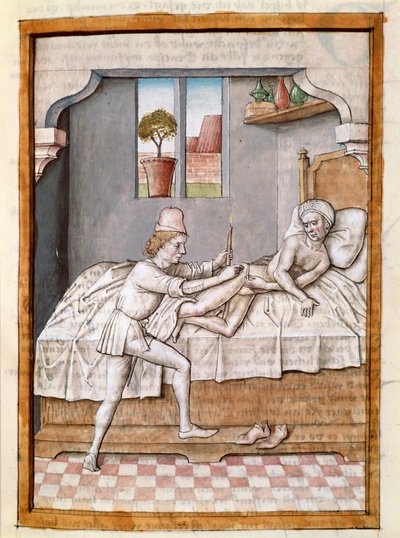En lege behandler en miniatyrpasient fra en tysk oversettelse av fablene om "Kalila (Calila) og Dimna" av Bidpai. (ms. 1389, fol. 23) rundt 1480 Chantilly, museum Conde av Unknown artist