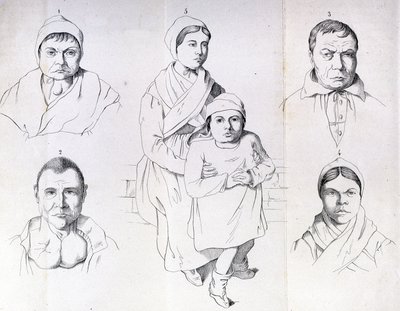 Betraktninger om årsakene til endemisk kretinisme av Morel. av Unknown artist