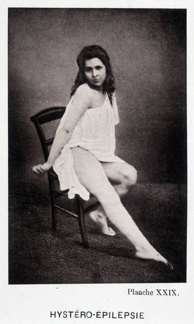 Hystero Epilepsie - Contracture in "" Fotografisk ikonografi av Salpétrière: service of Mr. Charcot" av Paul Regnard og Bourneville av Unknown artist