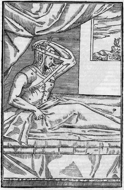 Nesekirurgi: Rekonstruktiv kirurgi på nesen i “De curtorum chirurgia per insitionem””. Venezia av Unknown artist