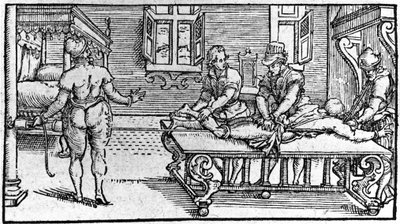 Reduksjon av en dislokasjon, -i "Medical Treatise" av Ambroise Paré, rundt 1560. av Unknown artist