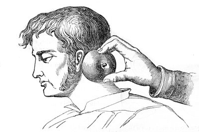 Saignee locales - application of leeches with an apple - engraving in “La Santo Universelle - Medical Guide for Families”” 1852 av Unknown artist