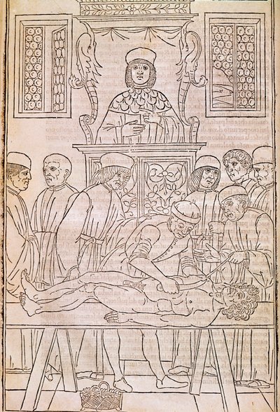 Autopsi. Kodice. Kroppen til en død person dissekeres av leger for en anatomistudie. “” Fascicula Medicinae””. Kodeks av en leges fascikel av Johannes Kethan av Unknown artist