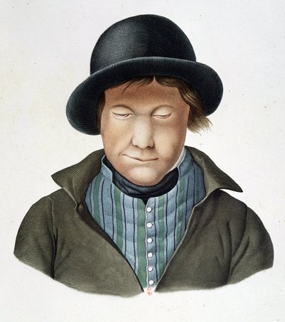 Spedalske av Island, rundt 1840, B.N. av Unknown artist