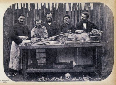 Disseksjon, v.1865. av Unknown photographer