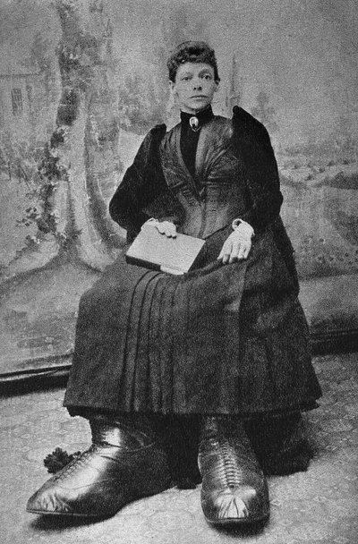 Monstrene, Bertha med store føtter. Fotografi, sent på 1800-tallet, Paris. Coll. Selva. av Unknown photographer
