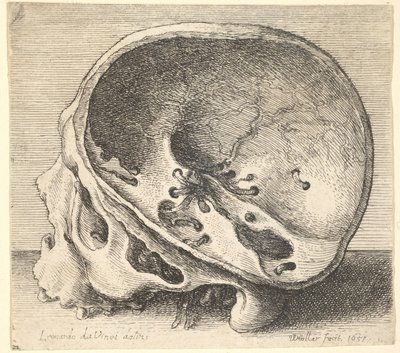 Seksjonert hodeskalle i profil til venstre med venstre side av kraniet fjernet, 1651. av Wenceslaus Hollar