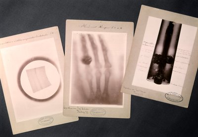 Originale røntgenbilder av Røntgen som viser (radiografi) av Wilhelm (after) Röntgen