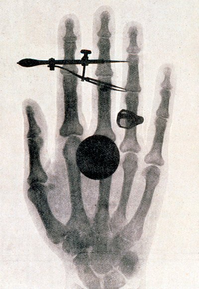 Wilhelm Roentgens røntgenfotografi av sin kones hånd, 1896 av Wilhelm Conrad Rontgen
