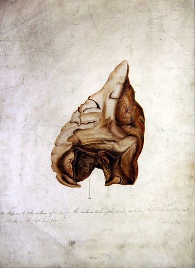 Study of Brain I, ca. 1850 (akvarell på papir) av William Lover