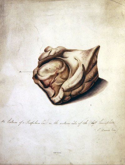 Study of the Brain II, ca. 1850 (akvarell på papir) av William Lover