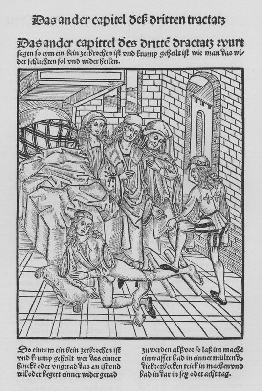 The Book of Cirurgia av Hieronymus Brunschwig (litho) av (after) German School