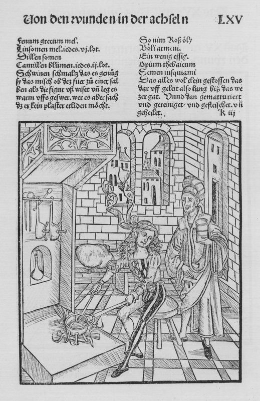 The Book of Cirurgia av Hieronymus Brunschwig (litho) av (after) German School